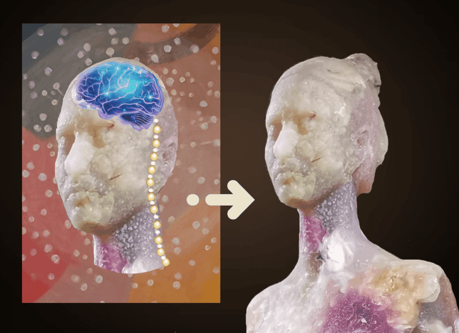 Afbeelding kalmerende werking EMDR in het brein